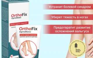 Orthofix: Инновационное Средство для Эффективного Лечения Вальгусной Деформации