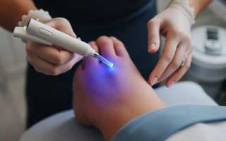 ЭЛОС-эпиляция: плюсы и минусы технологии для светлых и темных волос