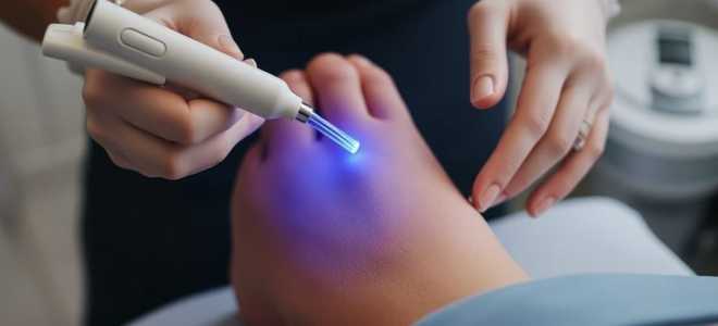 ЭЛОС-эпиляция: плюсы и минусы технологии для светлых и темных волос