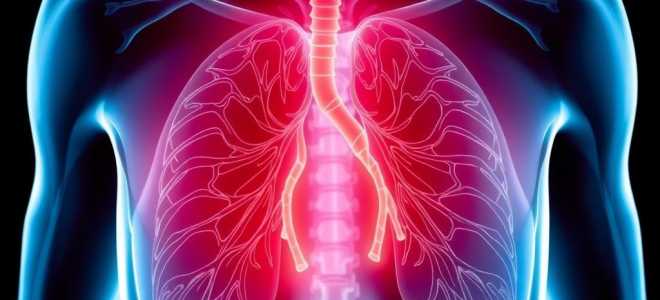 Как лечат пневмонию: понятная и практичная инструкция для пациентов и родственников