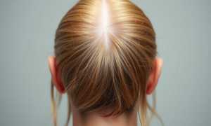 Плазмотерапия волос: как это работает, кому помогает и чего действительно ждать