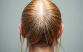 Плазмотерапия волос: как это работает, кому помогает и чего действительно ждать