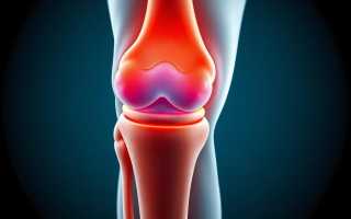 Артроскопия коленного сустава