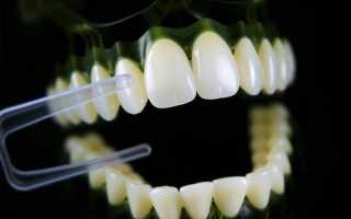 Зубные протезы: искусство восстановления улыбки и жевания