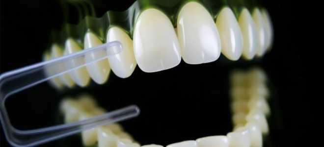 Зубные протезы: искусство восстановления улыбки и жевания